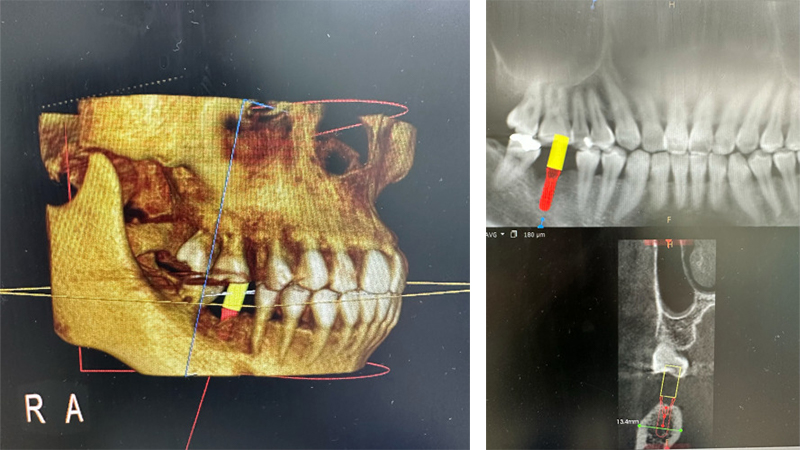 CTでの撮影イメージ